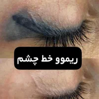 ریموو  هر نوع تتویی  کاملا تضمینی اف خورده|خدمات آرایشگری و زیبایی|کرمانشاه, |دیوار