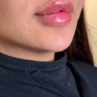 فیلر لب روسی عروسکی|خدمات آرایشگری و زیبایی|سلماس, |دیوار