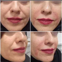 تخفیف تکرارنشدنی|خدمات آرایشگری و زیبایی|رشت, چله خانه|دیوار