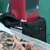 لیزر کیوسوئیچ (رفع لک صورت.رفع لک زیربغل.رفع تتو)|خدمات آرایشگری و زیبایی|رشت, پورسینا|دیوار