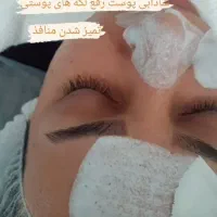 کلیه خدمات زیبایی و فیشال در کلینیک زیبایی میراکل|خدمات آرایشگری و زیبایی|لاهیجان, قیام|دیوار