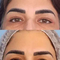 جشنواره عمل های زیبایی (اقساطی)|خدمات زیبایی و سلامت|اصفهان, سعادتآباد|دیوار