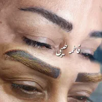 ریموو(پاک کردن تتو) با تضمین سلامت پوست