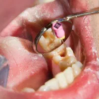 خدمات دندانپزشکی رایگان فرصت محدود زیر نظر متخصص|خدمات آرایشگری و زیبایی|تهران, فلسطین (میدان انقلاب)|دیوار