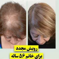 سرم سیرسیاه لاکچری کوین فرانسه وتونیک هیرفرندبیز|آرایشی، بهداشتی، درمانی|تبریز, |دیوار