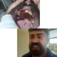 خدمات ویژه کامپوزیت ودندنسازی باقیمت ویژه