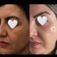 سفید برفی شو|آرایشی، بهداشتی، درمانی|اهواز, امانیه|دیوار