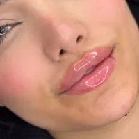 فقط امروز تزریق ژل با تخفیف عالی|خدمات آرایشگری و زیبایی|آبیک, |دیوار