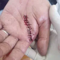 خدمات پرستاری در منزل.|خدمات آرایشگری و زیبایی|نجف‌آباد, هفده شهریور|دیوار