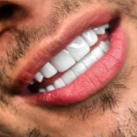 کامپوزیت کن بدون پیش پرداخت|خدمات آرایشگری و زیبایی|کرج, ساماندهی|دیوار