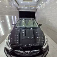 ریکاوری،شفاف سازی چراغ،ترمیم آفتاب سوختگی،سرامیک|خدمات موتور و ماشین|اهواز, کوی مهدیس|دیوار