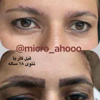 دیگه نگران تکرار زیاد جلسات پاک شدن تتوت نباش|خدمات آرایشگری و زیبایی|بندر گناوه, |دیوار