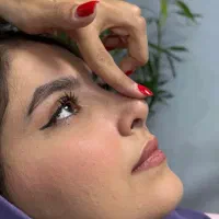 عمل بینی ، بلفاروپلاستی