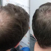 دیگه نیازی نیست بری مو بکاری
