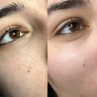 پاکسازی و فشیال صورت ویژه  بانوان و آقایان|خدمات آرایشگری و زیبایی|اردکان, |دیوار