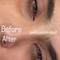 تخفیفات استثنایی ژل و بوتاکس در مطب زیبایی|خدمات آرایشگری و زیبایی|قم, دورشهر|دیوار