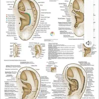 ترک سیگار و هرگونه اعتیاد با طب سوزنی|خدمات آرایشگری و زیبایی|کرمانشاه, |دیوار
