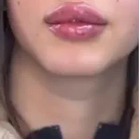 خدمات ژل و بوتاکس و لاغری