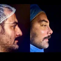 جشنواره لیپو .مامو .بینی بلفارو کل صورت .چک صیادی