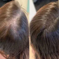 نمایندگی رسمی لاکچری کوین سرم سیرسیاه رویش مجددمو|آرایشی، بهداشتی، درمانی|قم, زنبیل آباد|دیوار