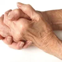 درمان دردهای روماتیسمی ،دردهای ناشناخته،پزشک متخصص