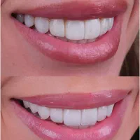انجام کلیه خدمات دندانپزشکی|خدمات آرایشگری و زیبایی|مشهد, آبکوه|دیوار
