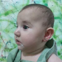 برداشتن خال۱۰ هزار تومن دریک جلسه،فیلر۳۹۰،جوانسازی|خدمات آرایشگری و زیبایی|کرج, گوهردشت|دیوار