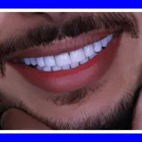 کامپوزیت دندان/دندانپزشکی/عصبکشی ترمیم روکش