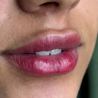 کلینیک لیزر  پوست و مو الیزا