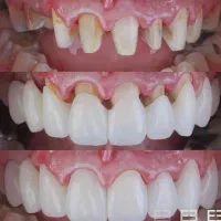 جشنواره یلدایی خدمات دندانپزشکی|خدمات آرایشگری و زیبایی|اردبیل, |دیوار