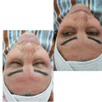 فیشال تخصصی پوست|خدمات آرایشگری و زیبایی|محمدشهر, محمدشهر|دیوار