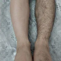 اپلاسیون با موم گیاهی