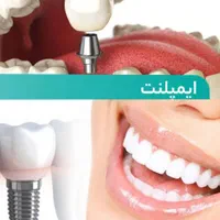 ایمپلنت دیجیتال یک روزه تمام اقساط با خدمات رایگان|خدمات آرایشگری و زیبایی|تهران, مهران|دیوار