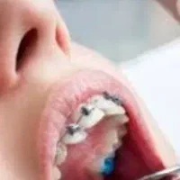 راهنمایی برای دندان پزشک