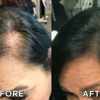 میکرواسکالپ تخصصی