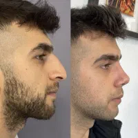 از یه تار تا ده تار