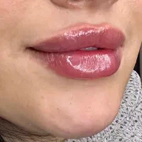 کلینیک زیبایی /شرایط اقساط بدون پیش پرداخت