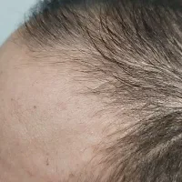 پودر جذاب حجم دهنده و حالت دهنده مو|آرایشی، بهداشتی، درمانی|مشهد, نیزه|دیوار