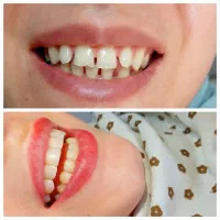 دندانپزشکی.کامپوزیت.ارتودنسی.روکش.عصبکشی|خدمات آرایشگری و زیبایی|کرمانشاه, |دیوار