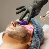 حذف تاتو با لیزر کیوسوئیچ و روشن کننده بیکینی صورت|خدمات آرایشگری و زیبایی|ارومیه, |دیوار