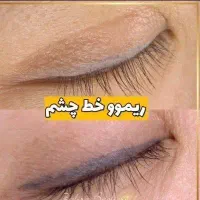 مدل ریموو خط چشم