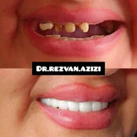 طرح لبخند، کامپویت تخصصی،اقساط،دندانپزشکی زیرتعرفه|خدمات آرایشگری و زیبایی|شیراز, قصرالدشت|دیوار