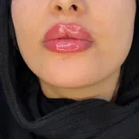 کلینیک پوست، مو، زیبایی، ژل، بوتاکس در پارس آباد