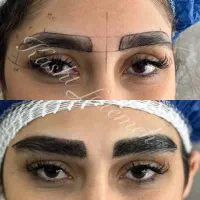 کاشت دائمی ابرو