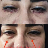 مرکز تخصصی جراحی بلفارو پلاستی دکتر الماس اسدی|خدمات آرایشگری و زیبایی|کرمانشاه, |دیوار