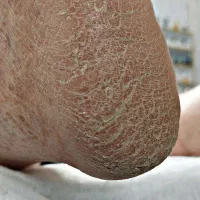 پدیکور و کفسابی پا|خدمات آرایشگری و زیبایی|قم, صدوق|دیوار