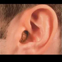 ارزانترین مرکز تجویز (سمعک) گوش ،سمک نامرئی تبریز|آرایشی، بهداشتی، درمانی|ارومیه, |دیوار