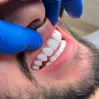 کامپوزیت دندان