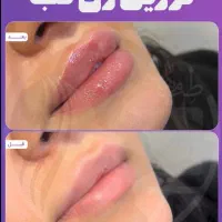 مطبپوست مو لیزر ولاغری|خدمات آرایشگری و زیبایی|مشهد, ایثار|دیوار