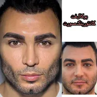 ساکشن غبغب بلفارو کاشت ابرو بوکال فت|خدمات آرایشگری و زیبایی|تهران, میرداماد|دیوار